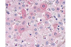 Anti-MKP-8 / DUSP26 antibody IHC of human liver. (DUSP26 antibody  (Internal Region))