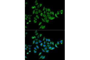 Immunofluorescence (IF) image for anti-Docking Protein 1, 62kDa (Downstream of tyrosine Kinase 1) (DOK1) (AA 1-280) antibody (ABIN6139763)
