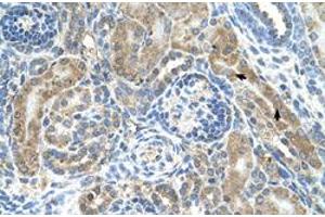 Immunohistochemical staining (Formalin-fixed paraffin-embedded sections) of human kidney with CRELD1 polyclonal antibody  at 4-8 ug/mL working concentration. (CRELD1 antibody  (C-Term))