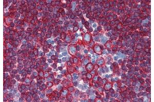 Immunohistochemistry staining of human small intestine (paraffin-embedded sections) with anti-HLA-DR+DP (HL-40). (HLA-DP/DR antibody)