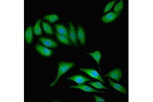 Immunofluorescent analysis of A549 cells using ABIN7171966 at dilution of 1:100 and Alexa Fluor 488-congugated AffiniPure Goat Anti-Rabbit IgG(H+L) (TAB3 antibody  (AA 361-712))