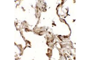 Immunohistochemistry of TFEB (NT) in human lung tissue with TFEB (NT) antibody at 2.