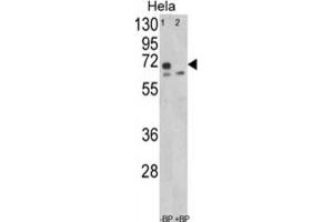 Western Blotting (WB) image for anti-Leiomodin 1 (LMOD1) antibody (ABIN3003829)