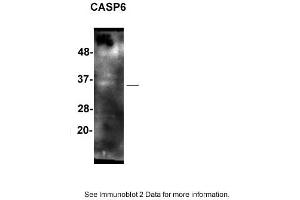 Sample: SH-SY5Y cells  2. (Caspase 6 antibody  (Middle Region))