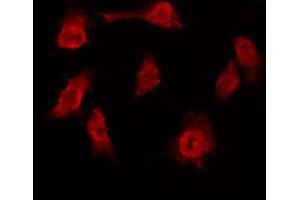 ABIN6272449 staining 293 by IF/ICC. (TRF1 antibody  (Internal Region))