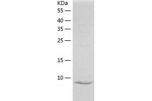Western Blotting (WB) image for Amphiregulin (AREG) (AA 101-198) protein (His tag) (ABIN7285434) (Amphiregulin Protein (AREG) (AA 101-198) (His tag))