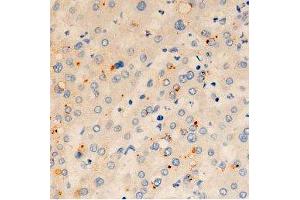 ABIN6278065 at 1/100 staining human liver tissue sections by IHC-P. (ORAI1 antibody  (C-Term))