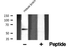 Western blot analysis of GLU2B expression in mouse brain lysate (PRKCSH antibody  (Internal Region))