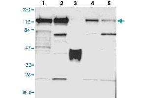 Western blot analysis of Lane 1: RT-4, Lane 2: U-251 MG, Lane 3: Human Plasma, Lane 4: Liver, Lane 5: Tonsil with PPFIBP1 polyclonal antibody  at 1:250-1:500 dilution.