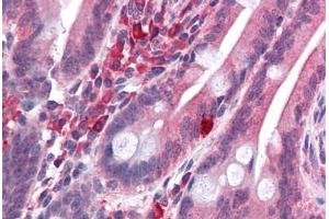 Human Small Intestine: Formalin-Fixed, Paraffin-Embedded (FFPE) (LYRM2 antibody  (C-Term))