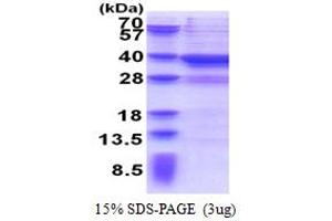 SDS-PAGE (SDS) image for metallophosphoesterase Domain Containing 2 (MPPED2) (AA 1-294) protein (His tag) (ABIN5853344) (MPPED2 Protein (AA 1-294) (His tag))