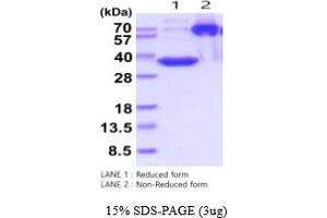 SDS-PAGE (SDS) image for Microfibrillar-Associated Protein 4 (MFAP4) (AA 22-255) protein (His tag) (ABIN5778840)
