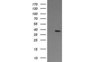 Image no. 1 for anti-Nudix (Nucleoside Diphosphate Linked Moiety X)-Type Motif 9 (NUDT9) antibody (ABIN1499875)
