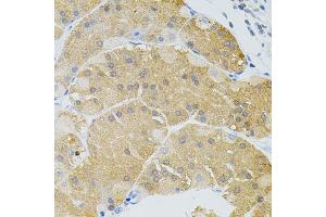 Immunohistochemistry of paraffin-embedded human stomach using SYK Antibody (ABIN5971150) at dilution of 1/100 (40x lens). (SYK antibody)