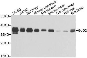 Western blot analysis of extracts of various cell lines, using GJD2 antibody.
