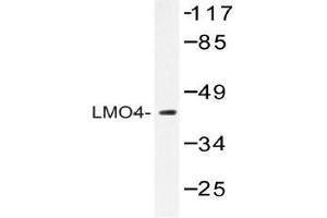 Western blot (WB) analysis of LMO4 antibody in extracts from 293 cells.