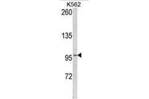 Western blot analysis of LPIN2 Antibody (Lipin 2 antibody  (Middle Region))