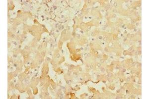 Immunohistochemistry of paraffin-embedded human liver tissue using ABIN7170776 at dilution of 1:100 (SOAT2 antibody  (AA 1-120))