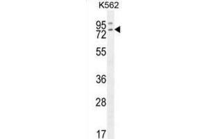Western Blotting (WB) image for anti-RAS Guanyl Releasing Protein 2 (Calcium and DAG-Regulated) (RASGRP2) antibody (ABIN2996572) (RASGRP2 antibody)