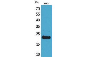 Western Blotting (WB) image for anti-Leukemia Inhibitory Factor (LIF) (C-Term) antibody (ABIN3180980) (LIF antibody  (C-Term))