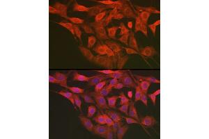 Immunofluorescence (IF) image for anti-Lectin, Mannose-Binding 2-Like (LMAN2L) antibody (ABIN7268204)