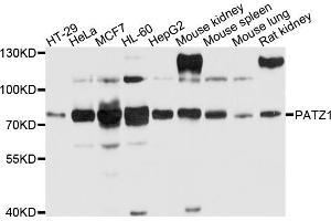 Western blot analysis of extracts of various cell lines, using PATZ1 antibody (ABIN4904681) at 1:1000 dilution. (PATZ1 antibody)