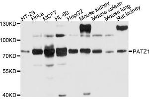 Western blot analysis of extracts of various cell lines, using PATZ1 antibody (ABIN4904681) at 1:1000 dilution.