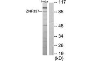 Western blot analysis of extracts from HeLa cells, using ZNF337 Antibody. (ZNF337 antibody  (AA 471-520))