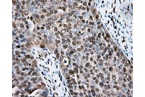 Immunohistochemical staining of paraffin-embedded colon tissue using anti-CYP1A2 mouse monoclonal antibody. (CYP1A2 antibody)