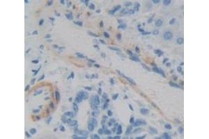 Figure. (IFNA5 antibody  (AA 24-189))