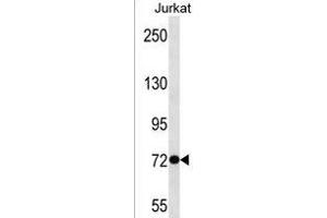 ANKRD56 Antibody (Center) (ABIN1538405 and ABIN2850334) western blot analysis in Jurkat cell line lysates (35 μg/lane). (SOWAHB antibody  (AA 412-438))