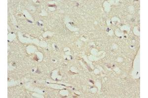 IHC analysis of paraffin-embedded human brain tissue, using NT-proBNP antibody (1/100 dilution). (NT-ProBNP antibody  (AA 27-102))