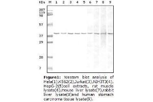 Image no. 1 for anti-Glyceraldehyde-3-Phosphate Dehydrogenase (GAPDH) antibody (ABIN207608) (GAPDH antibody)