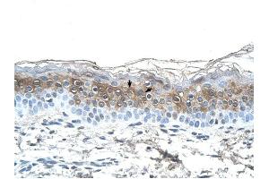 Fibrinogen Alpha antibody was used for immunohistochemistry at a concentration of 4-8 ug/ml to stain Squamous epithelial cells (arrows) in Human Skin. (FGA antibody  (N-Term))