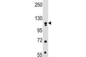 Western Blotting (WB) image for anti-Muscle, Skeletal, Receptor Tyrosine Kinase (MUSK) antibody (ABIN3031879)