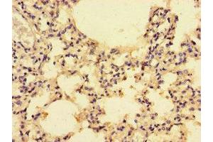 Immunohistochemistry of paraffin-embedded human lung tissue using ABIN7146002 at dilution of 1:100 (CCL4 antibody  (AA 24-84))