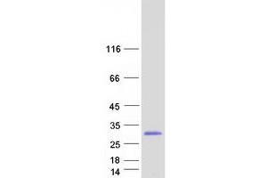 Ras Homolog Gene Family, Member C (RHOC) (Transcript Variant 2) protein (Myc-DYKDDDDK Tag)