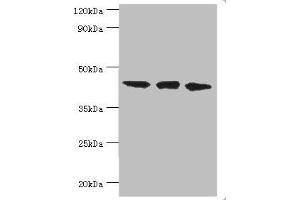 Western blot All lanes: TAR DNA-binding protein 43 antibody at 8 μg/mL Lane 1: Hela whole cell lysate Lane 2: Mouse spleen tissue Lane: K562 whole cell lysate Secondary Goat polyclonal to rabbit IgG at 1/10000 dilution Predicted band size: 45, 32 kDa Observed band size: 45 kDa
