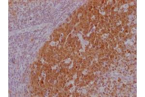 IHC image of ABIN7180562 diluted at 1:100 and staining in paraffin-embedded human lymph node tissue performed on a Leica BondTM system. (POU2AF1 antibody)