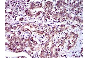 Immunohistochemistry (IHC) image for anti-ATP-Binding Cassette, Sub-Family G (WHITE), Member 5 (ABCG5) (AA 306-367) antibody (ABIN1845666) (ABCG5 antibody  (AA 306-367))