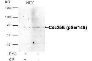 Western blot analysis of extracts from HT29 cells, treated with PMA or calf intestinal phosphatase (CIP), using Cdc25B (Phospho-Ser149) Antibody. (CDC25B antibody  (pSer149))