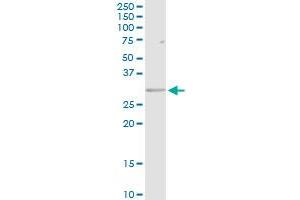 HLA-DRB5 MaxPab rabbit polyclonal antibody. (HLA-DRB5 antibody  (AA 1-266))