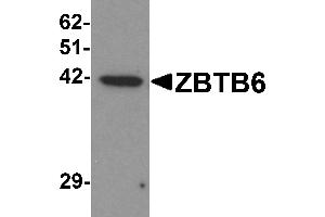 Western blot analysis of ZBTB6 in EL4 cell lysate with ZBTB6 antibody at 1 µg/mL. (ZBTB6 antibody  (Middle Region))