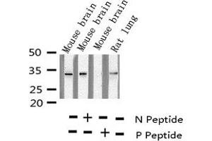 Western blot analysis of Phospho-S6 Ribosomal Protein (Ser235) expression in various lysates (RPS6 antibody  (pSer235))