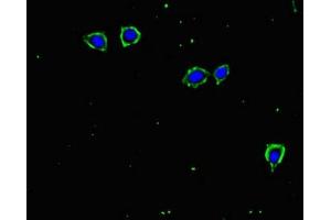 Immunofluorescent analysis of MCF-7 cells using ABIN7171961 at dilution of 1:100 and Alexa Fluor 488-congugated AffiniPure Goat Anti-Rabbit IgG(H+L) (TGFBR2 antibody  (AA 25-159))