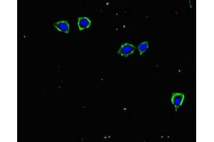 Immunofluorescent analysis of MCF-7 cells using ABIN7171961 at dilution of 1:100 and Alexa Fluor 488-congugated AffiniPure Goat Anti-Rabbit IgG(H+L)