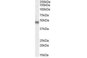 Image no. 1 for anti-Potassium Inwardly-Rectifying Channel, Subfamily J, Member 11 (KCNJ11) (Internal Region), (N-Term) antibody (ABIN374886) (KCNJ11 antibody  (Internal Region, N-Term))
