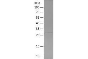 Western Blotting (WB) image for Keratin 6B (KRT6B) (AA 5-90) protein (His-IF2DI Tag) (ABIN7123677) (Keratin 6B Protein (KRT6B) (AA 5-90) (His-IF2DI Tag))