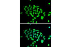 Immunofluorescence analysis of A549 cell using DPP8 antibody. (DPP8 antibody)