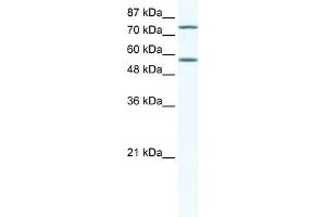 WB Suggested Anti-IRF4 Antibody Titration:  5ug/ml  Positive Control:  Jurkat cell lysate (IRF4 antibody  (N-Term))